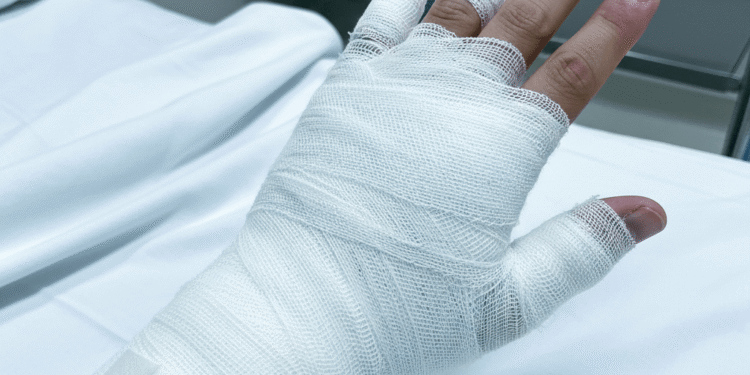 ¡Y no aprendemos! Dos lesionados con pólvora dejó el comienzo de la Navidad en Bello